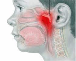 мастоидит, боль в области уха, верхней челюсти, ЛОР