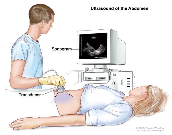 dopler_dnepr_st.antipa_ultrasonography_ of_ abdomen.jpg dopler_dnepr_st.antipa_ultrasonography_ of_ abdomen.jpg