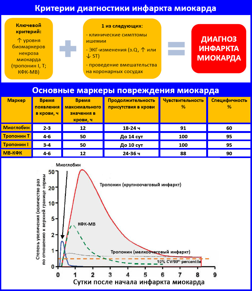 инфаркт миокарда_ Днепр_Поликлиника Св. Антипы