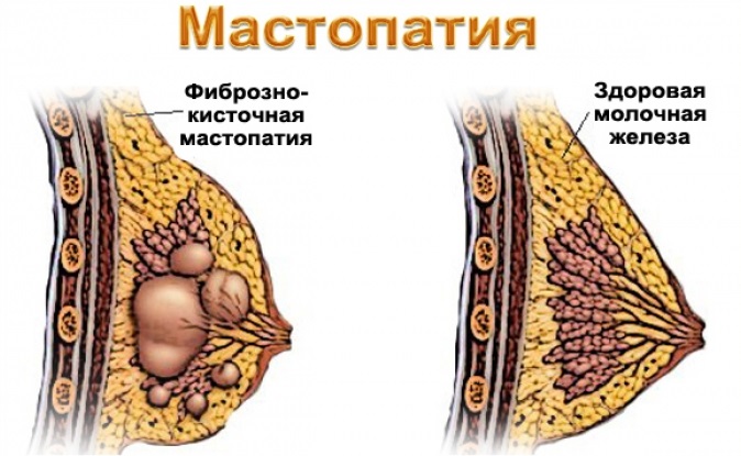 d0bcd0b0d181d182d0bed0bfd0b0d182d0b8d18f.jpg d0bcd0b0d181d182d0bed0bfd0b0d182d0b8d18f.jpg