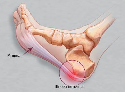 rentgenografiya_stopy_golenostopnogo_sustava_st.antipa_dnepr.jpg