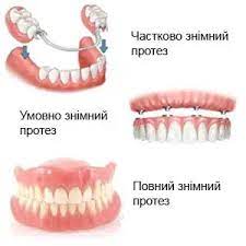 Протезирование и импланты в Днепре, Поликлиника Св. Антипы Протезирование и импланты в Днепре, Поликлиника Св. Антипы