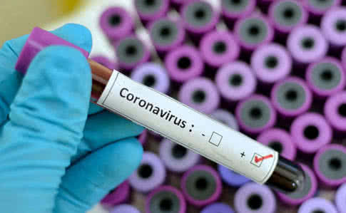 SARS-CoV-2_st_antipa_dnepr_test_Covid-19.jpg SARS-CoV-2_st_antipa_dnepr_test_Covid-19.jpg