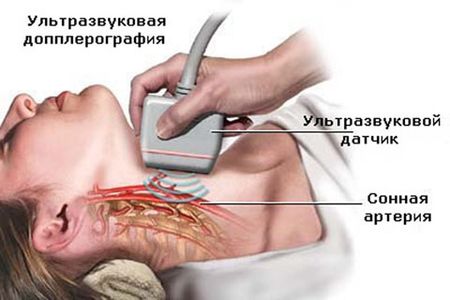 dopler_dnepr_st.antipa.jpg
