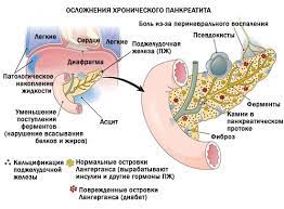 хронический панкреатит, Днепр, Поликлиника Св. Антипы, гастроэнтеролог, обследование, УЗИ