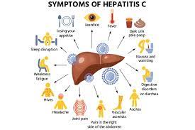 гепатит С, гепатит, болезни печени, цирроз, желтуха, гастроэнтеролог