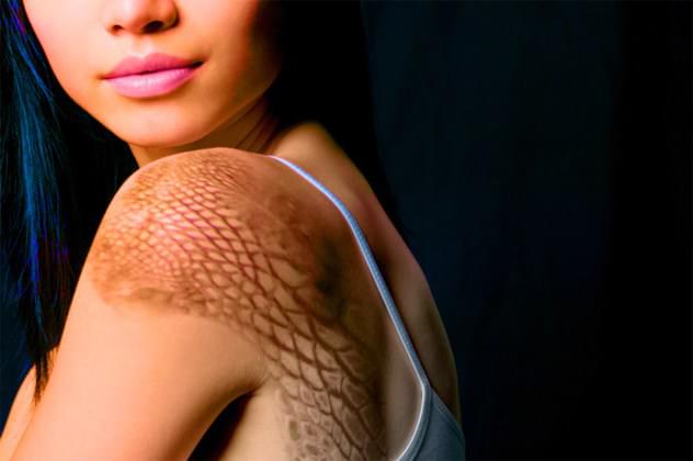 plastinchatyy_ikhtioz_cosmetolog_dnepr_tumanova.jpg plastinchatyy_ikhtioz_cosmetolog_dnepr_tumanova.jpg