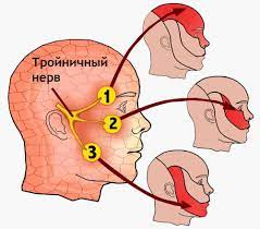 тройничный нерв, головная боль, анатомия инервации тройничный нерв, головная боль, анатомия инервации