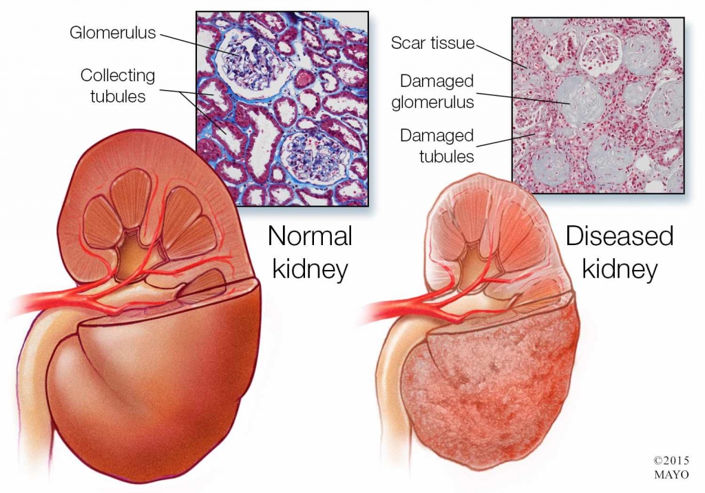 kidney.jpg