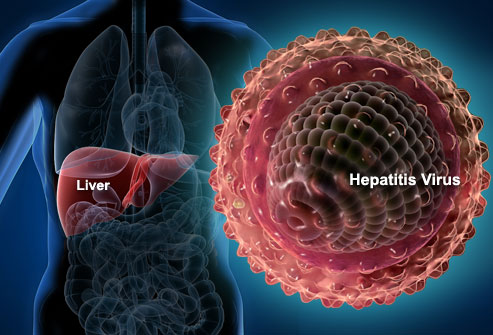 webmd_rf_photo_of_liver_and_hepatitis_virus.jpg webmd_rf_photo_of_liver_and_hepatitis_virus.jpg