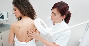 dermatologist_st.antipa_dnepr_papilloma_nevus.jpg