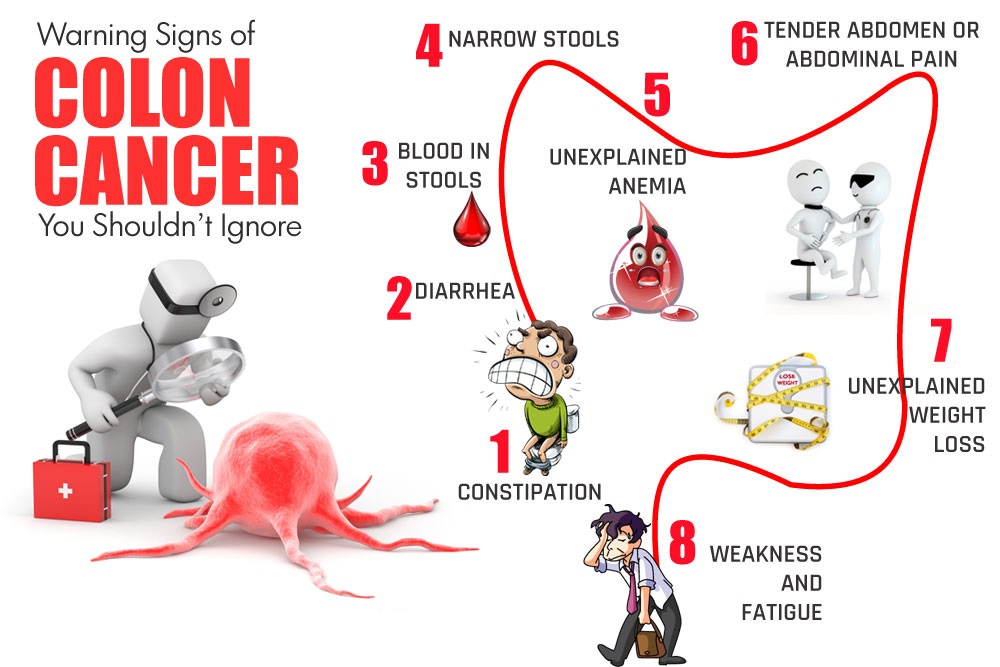 colon-cancer-rev.jpg colon-cancer-rev.jpg
